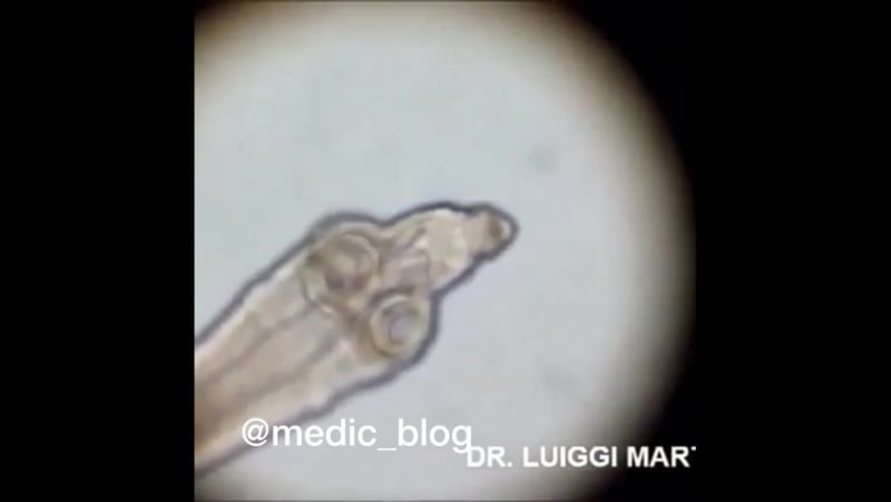 Свиной цепень