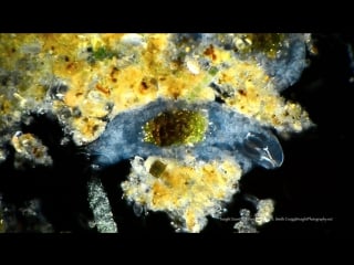 Water bear (tardigrade) in darkfield and polarized light 100 350x