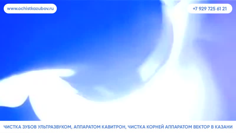 – чистка зубов с эффектом отбеливания в казани