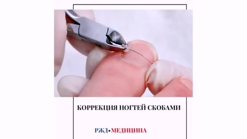 Rzd medicine 20200809 135227 0 mp4