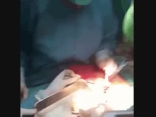 Что только не достают из желудка