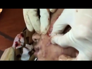 Вот такой новый для нас, интересный способ чистки лица