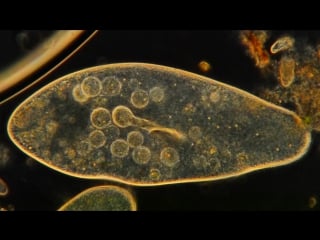 Amazing microscopic hd video! paramecium feeding!!