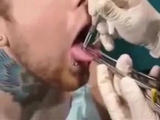 Tongue splitting porn body modification