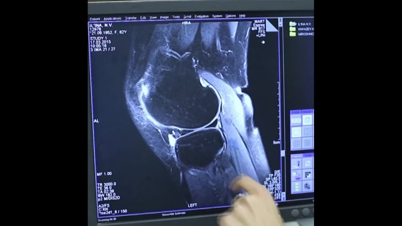 Бесплатная диагностика суставов!