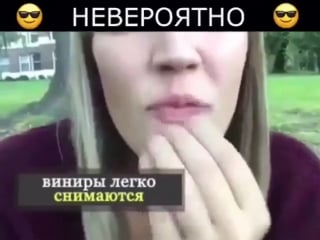 👄 perfect smile veneers