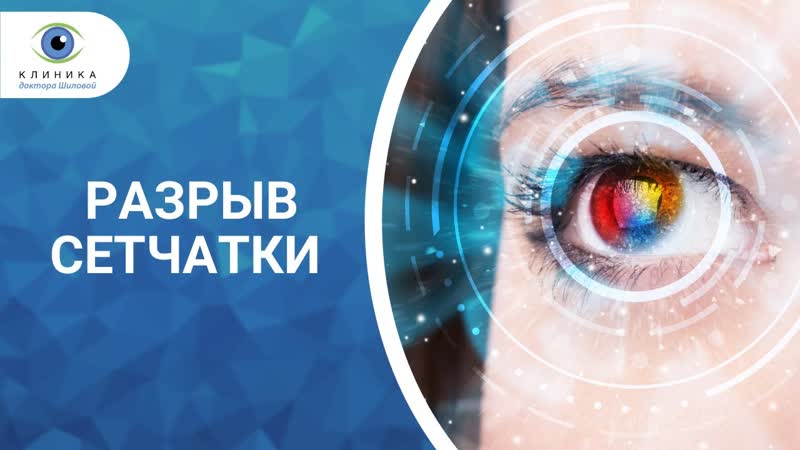 Макулярный разрыв сетчатки