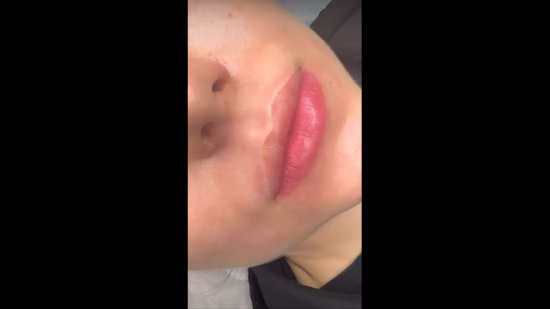 Напыление губ