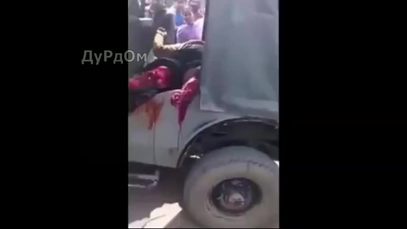 Жесткая травма ног, последствия дтп (480p) mp4