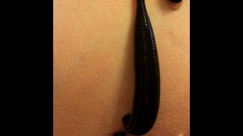 Гирудотерапия лечение пияами 89119737440