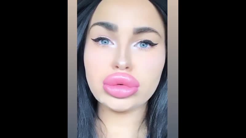 #lipsfiller #lipfiller #biglips #hugelips #siliconelips #пухлыегубы #силиконовыегыбы #большиегубы #филлер #filler #fillers #lips