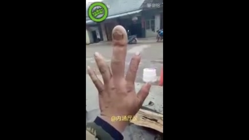Укусила пчела
