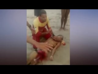 Shark r ips off swimmers penis as horrified beachgoers try to tie garments arou