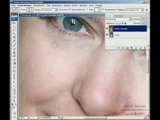 Уроки по photoshop ретуширование удаление дефектов на лице