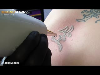 Лазерное удаление татуировок калининград magnum tattoo