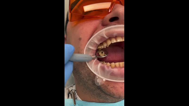 Лечим одной рукой!