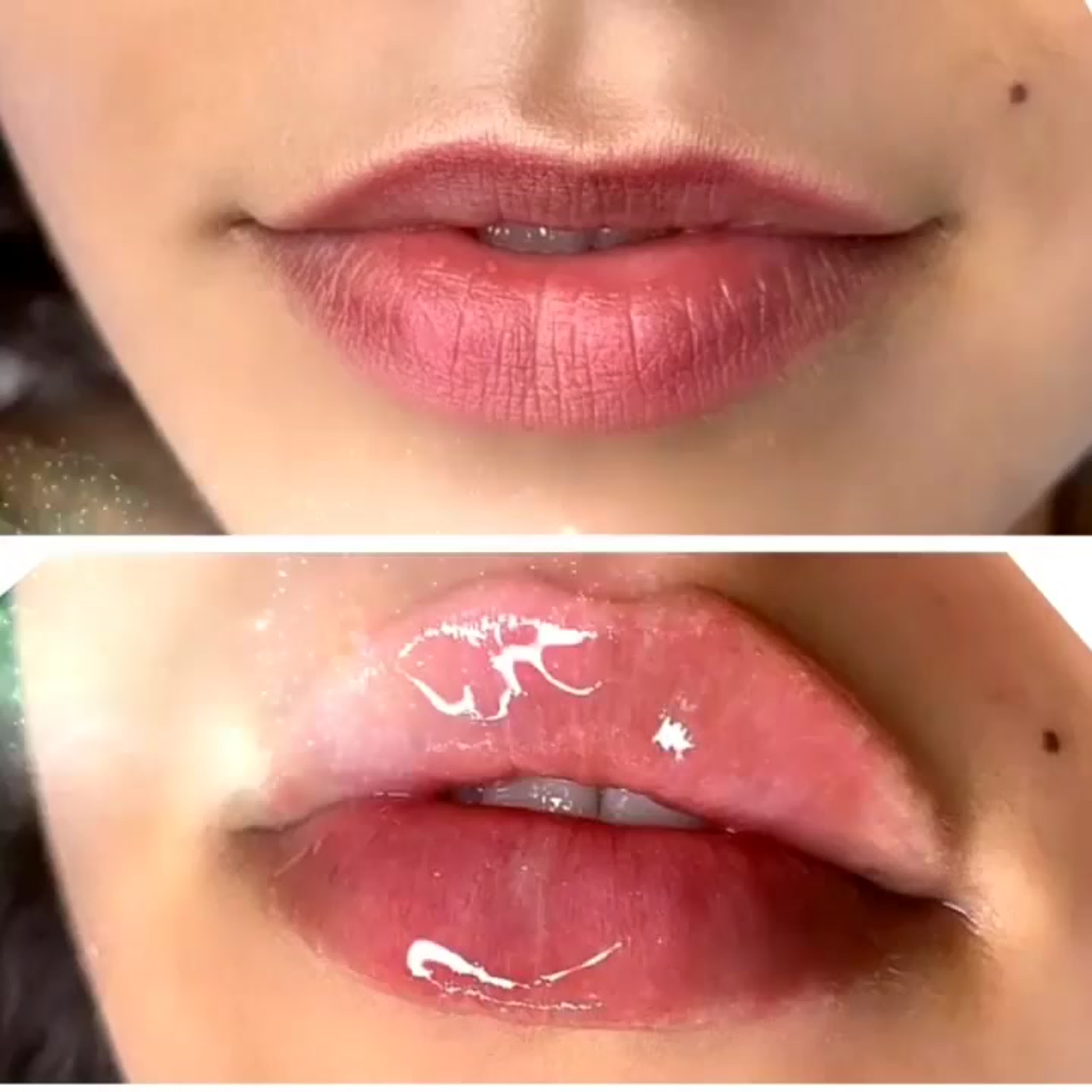 Dr antonina guz 20200715 103558 0 mp4 watch online