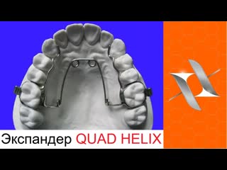 Ортодонтический аппарат квадхеликс оrthodontic appliance quad helix