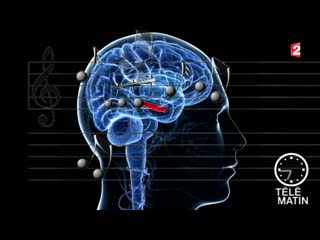 Santé musique et cerveau