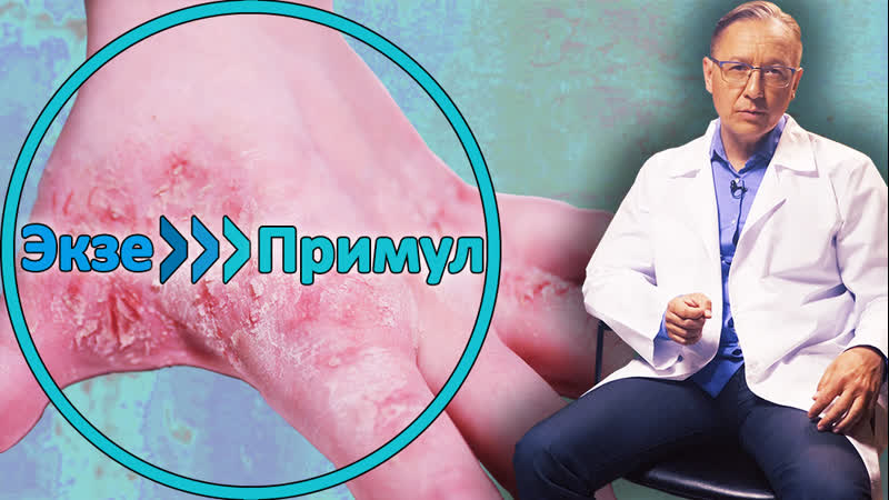 🚀как быстро и эффективно вылечить экзему?