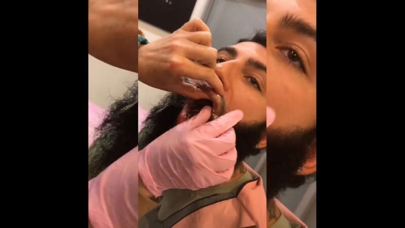 Бородатый кайфарик накачал губы