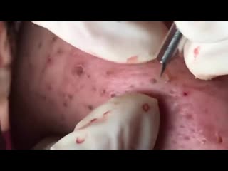 Плотные черные точки