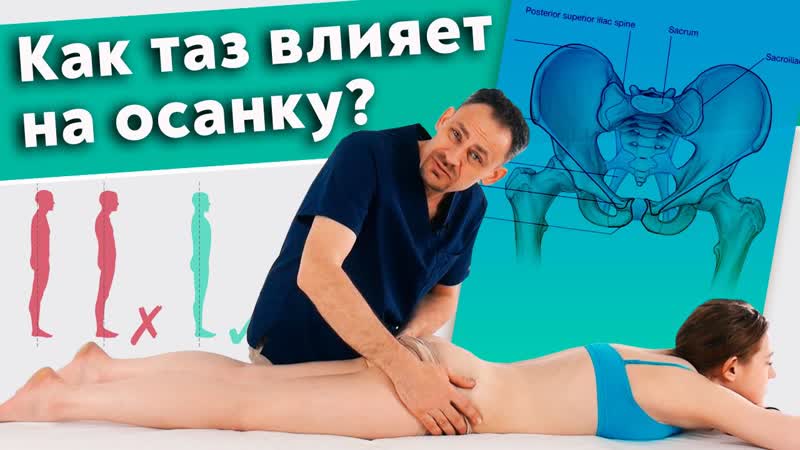 Как исправить осанку? перекос таза, как причина нарушения осанки!