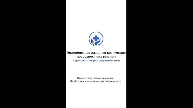 Эндовенозная лазерная коагуляция поверхностных вен нижних конечностей (эвлк)