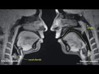 Life looks really different through an mri