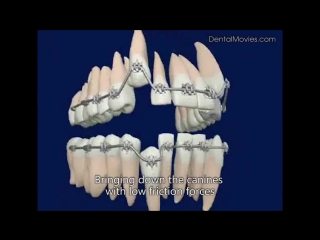 Animation of swlf ортодонтия пропедевтика