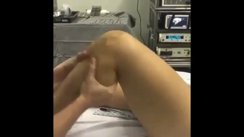 Разрыв передней крестообразной связки колена