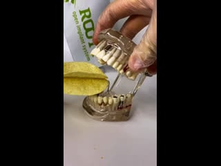 Что любит кариес ?🦷😅