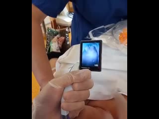 Оротрахеальная интубация