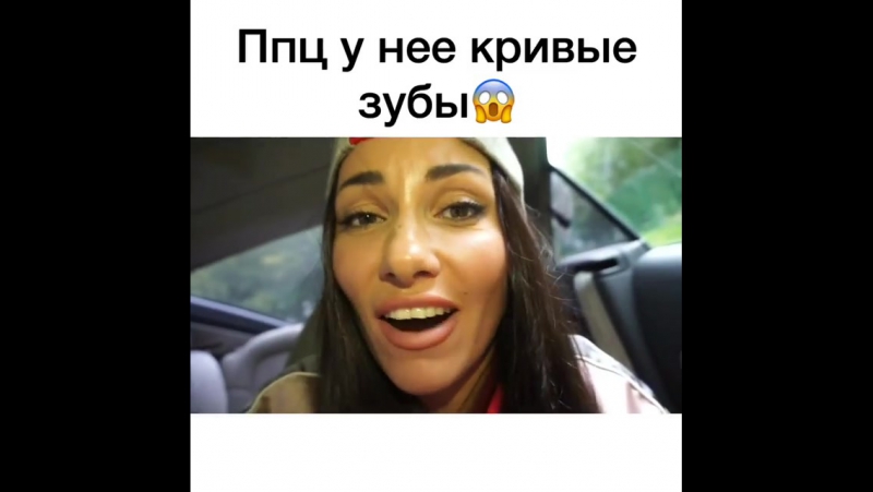 Ппц у неё кривые зубы 😱