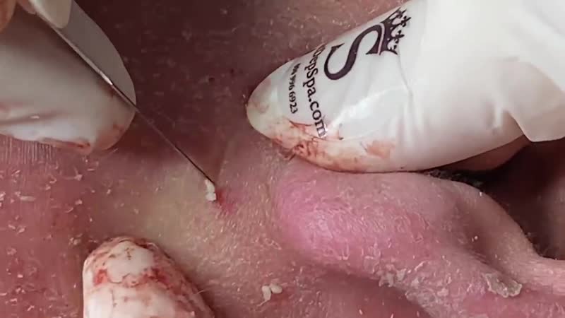 "тысяча выдавливаний", 8 сезон, серия 3 из 3