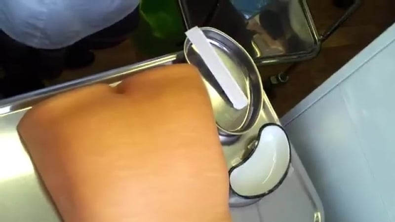 Мазок на энтеробиоз