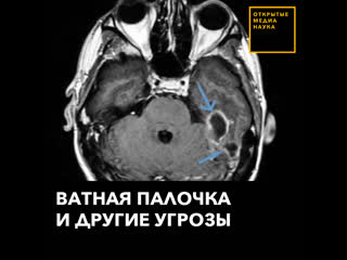 Ватная палочка и другие угрозы