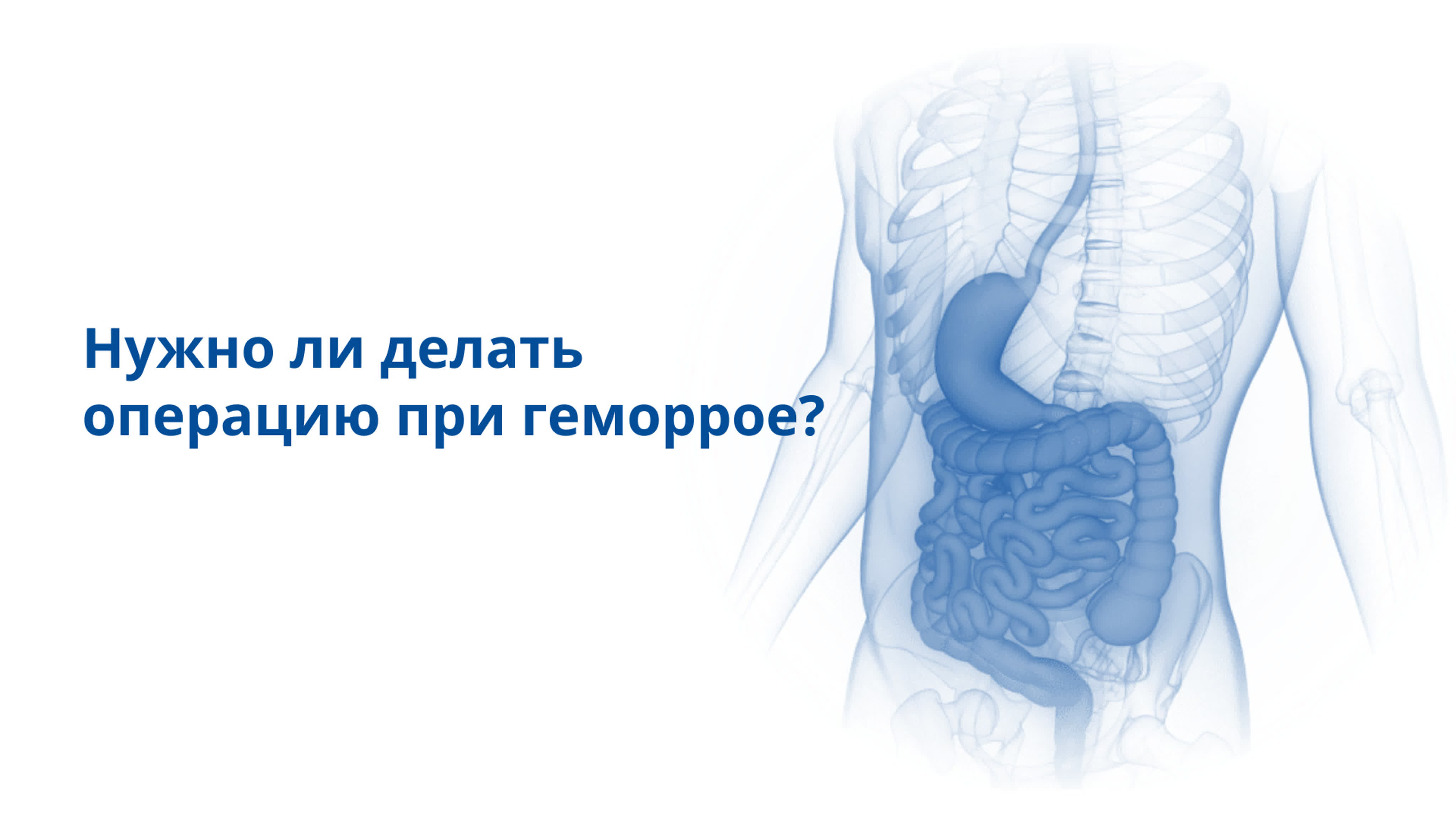 Нужно ли делать операцию при геморрое?