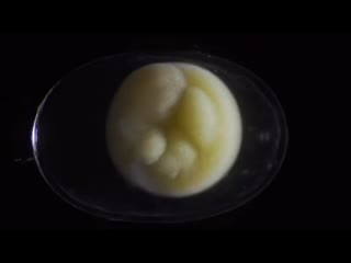 Becoming from zygote to tadpole, in six stunning minutes