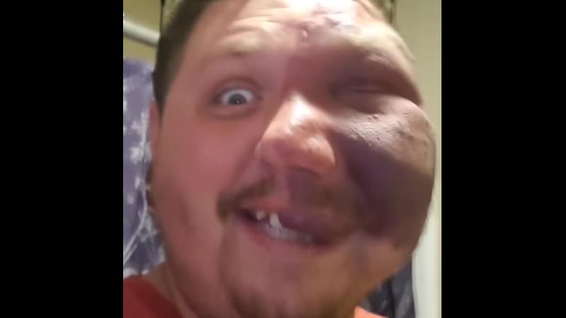 Отвесил оплеуху