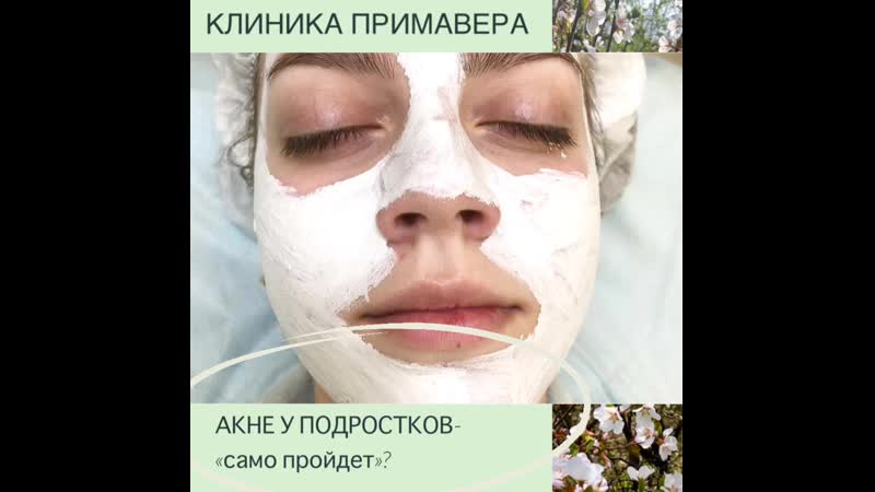 Примавера молодые акне