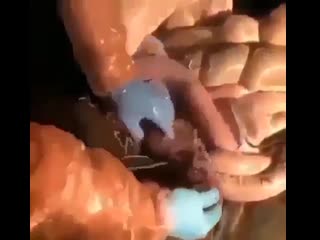 Очень много аскарид