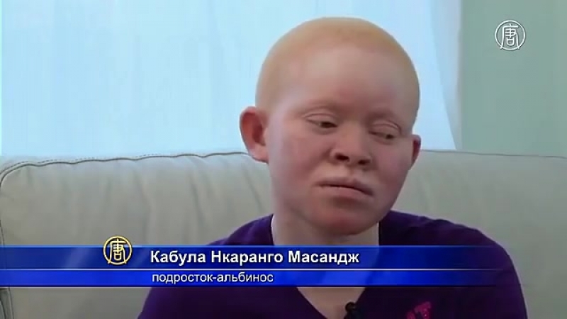 Белые негры (по натуре, реально белые альбиносы)!