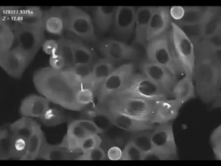 Процесс деления раковых клеток