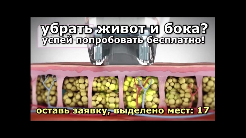 Нашем porn video – Пример процедуры в нашем центре