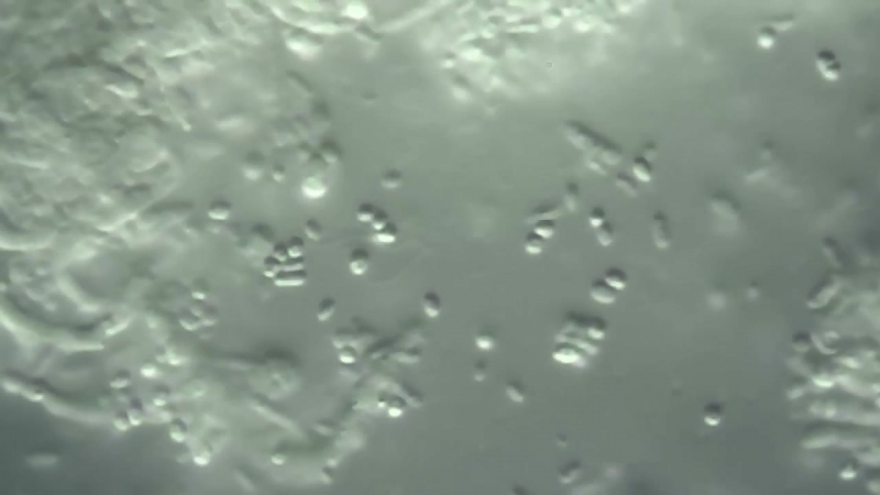 Бактерии крупным планом