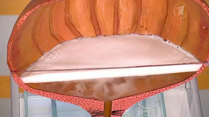 Еда и болезни чего не стоит есть при цистите