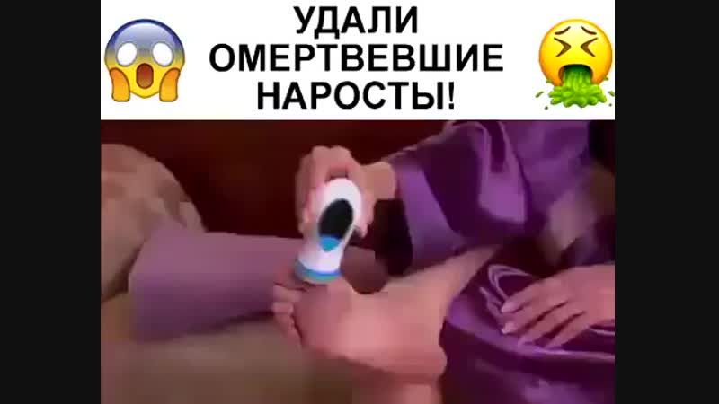 Красивые ножки без трещин, мозолей и натоптышей