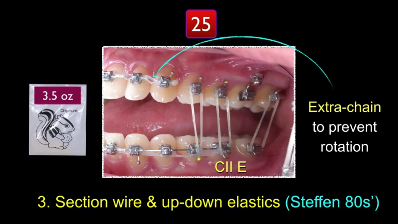 Simplify cii correction part