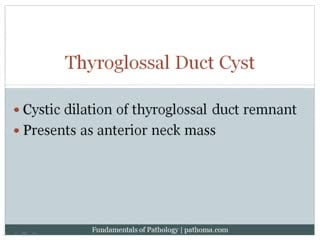 15 3 thyroid gland 15 4 hyperthyroidism 15 5 hypothyroidism 15 6 thyroiditis 15 7 thyroid neoplasia